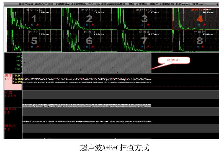 超聲波掃查.jpg